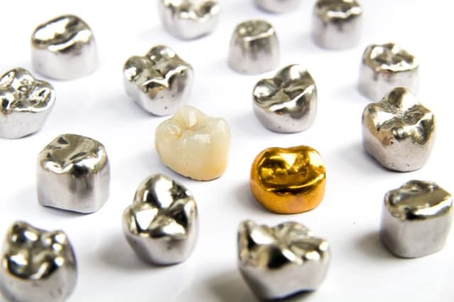 Tandheelkundige kronen en brugwerk van diverse legeringen, discrete tandgoud-inkoop en taxatie van tandtechnisch goud